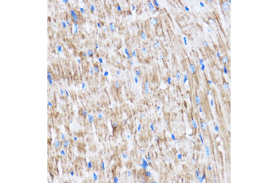 Immunohistochemistry - Anti-LATS2 Antibody (A88320) - Antibodies.com