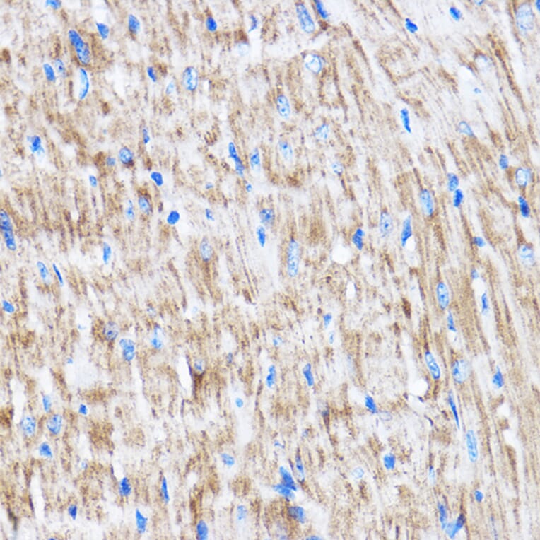 Immunohistochemistry - Anti-LATS2 Antibody (A88320) - Antibodies.com