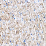 Immunohistochemistry - Anti-LATS2 Antibody (A88320) - Antibodies.com