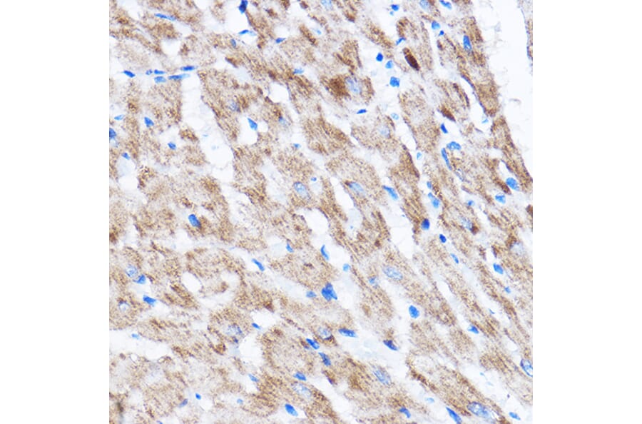 Immunohistochemistry - Anti-LATS2 Antibody (A88320) - Antibodies.com