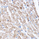 Immunohistochemistry - Anti-LATS2 Antibody (A88320) - Antibodies.com