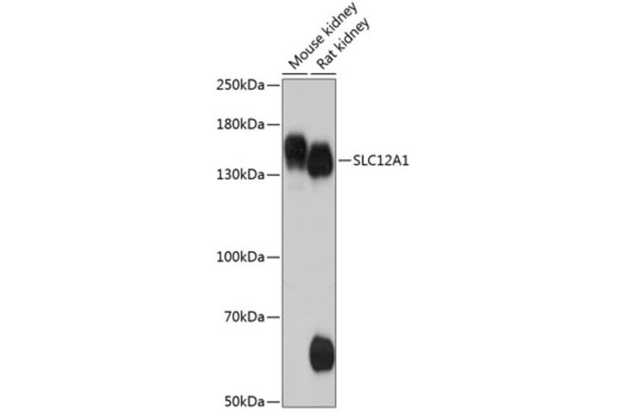 Western Blot - Anti-SLC12A1/NKCC2 Antibody (A88322) - Antibodies.com