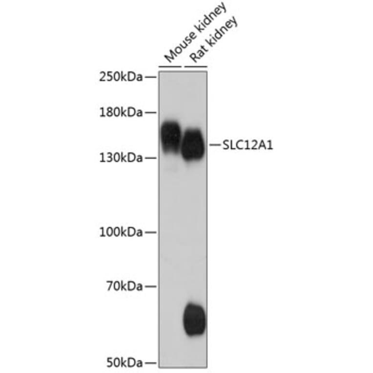 Western Blot - Anti-SLC12A1/NKCC2 Antibody (A88322) - Antibodies.com