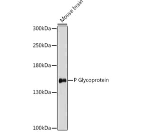 Western Blot - Anti-P Glycoprotein Antibody (A88323) - Antibodies.com