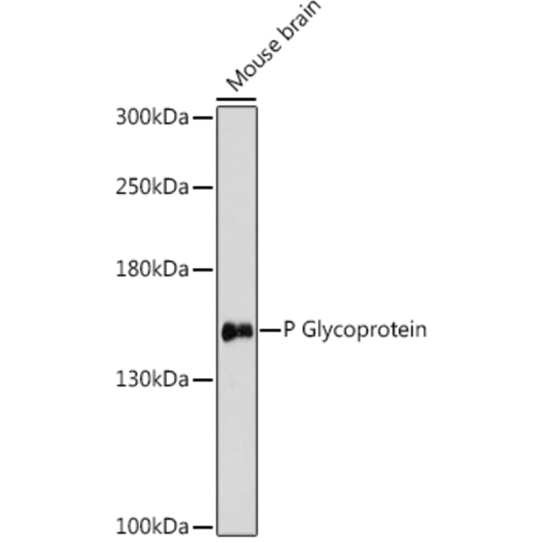 Western Blot - Anti-P Glycoprotein Antibody (A88323) - Antibodies.com