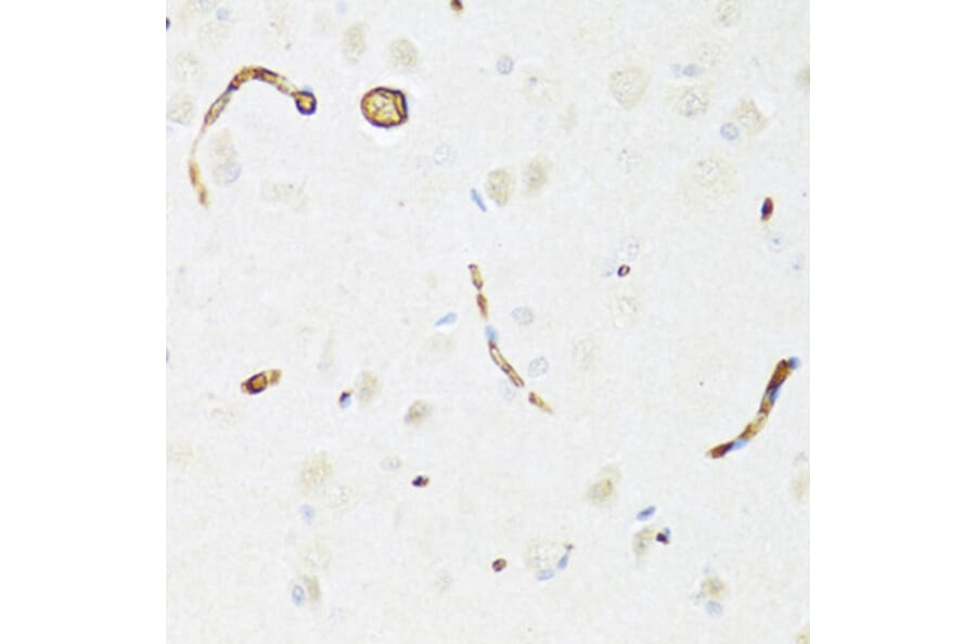 Immunohistochemistry - Anti-P Glycoprotein Antibody (A88323) - Antibodies.com