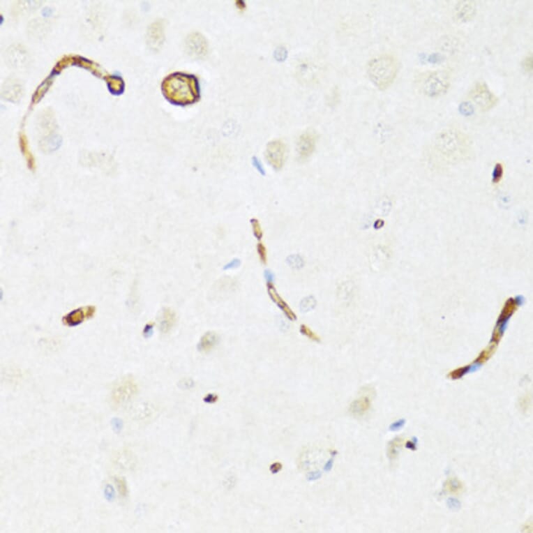 Immunohistochemistry - Anti-P Glycoprotein Antibody (A88323) - Antibodies.com