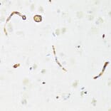 Immunohistochemistry - Anti-P Glycoprotein Antibody (A88323) - Antibodies.com