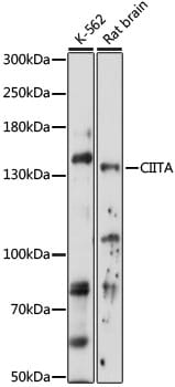 Western blot analysis of extracts of various cell lines, using Anti-CIITA Antibody (A16401) at 1:1,000 dilution.
Secondary antibody: Goat Anti-Rabbit IgG (H+L) (HRP) (AS014) at 1:10,000 dilution.
Lysates / proteins: 25µg per lane.
Blocking buffer: 3% non-fat dry milk in TBST.
Detection: ECL Basic Kit (RM00020).
Exposure time: 5s.