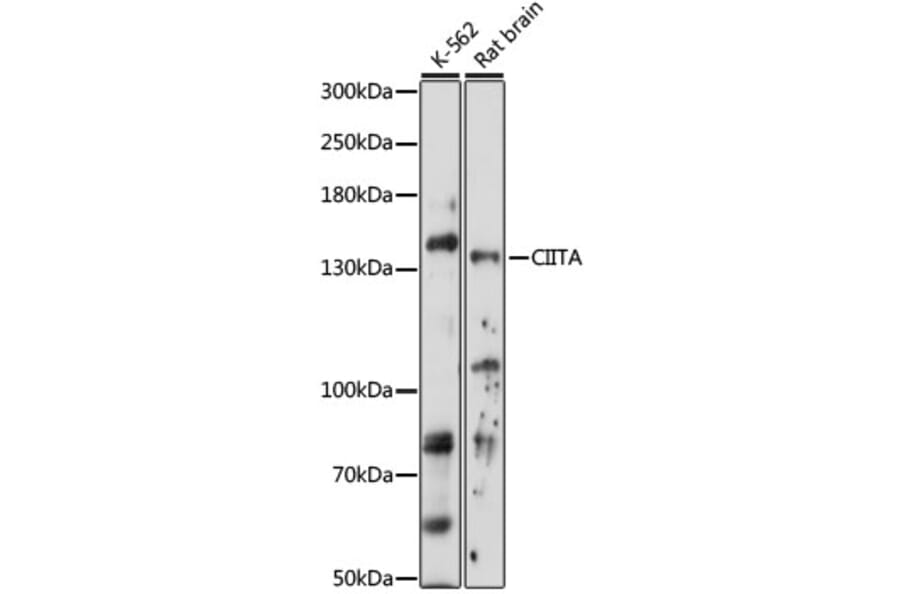 Western Blot - Anti-CIITA Antibody (A88324) - Antibodies.com