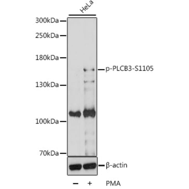 Western Blot - Anti-Phospholipaselipase C beta 3/PLCB3 (phospho Ser1105) Antibody (A88325) - Antibodies.com