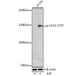Western Blot - Anti-ULK1 (phospho Ser757) Antibody (A88326) - Antibodies.com
