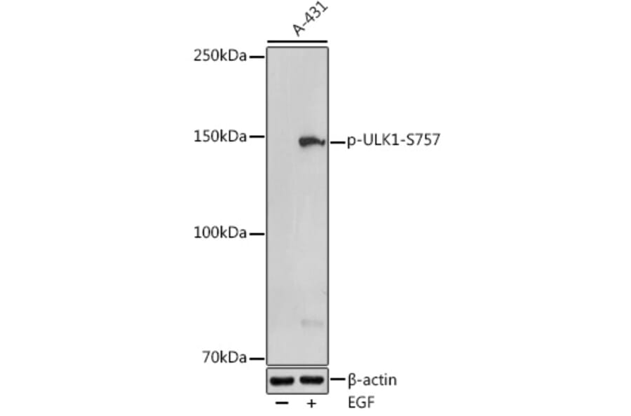 Western Blot - Anti-ULK1 (phospho Ser757) Antibody (A88326) - Antibodies.com