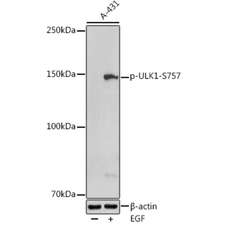 Western Blot - Anti-ULK1 (phospho Ser757) Antibody (A88326) - Antibodies.com