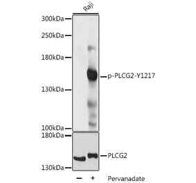 Western Blot - Anti-PLCG 2 (phospho Tyr1217) Antibody (A88327) - Antibodies.com