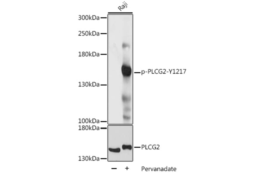 Western Blot - Anti-PLCG 2 (phospho Tyr1217) Antibody (A88327) - Antibodies.com