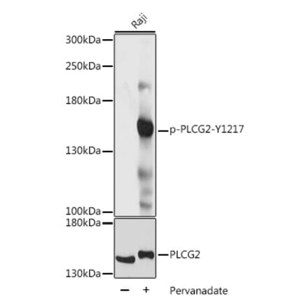 Western Blot - Anti-PLCG 2 (phospho Tyr1217) Antibody (A88327) - Antibodies.com