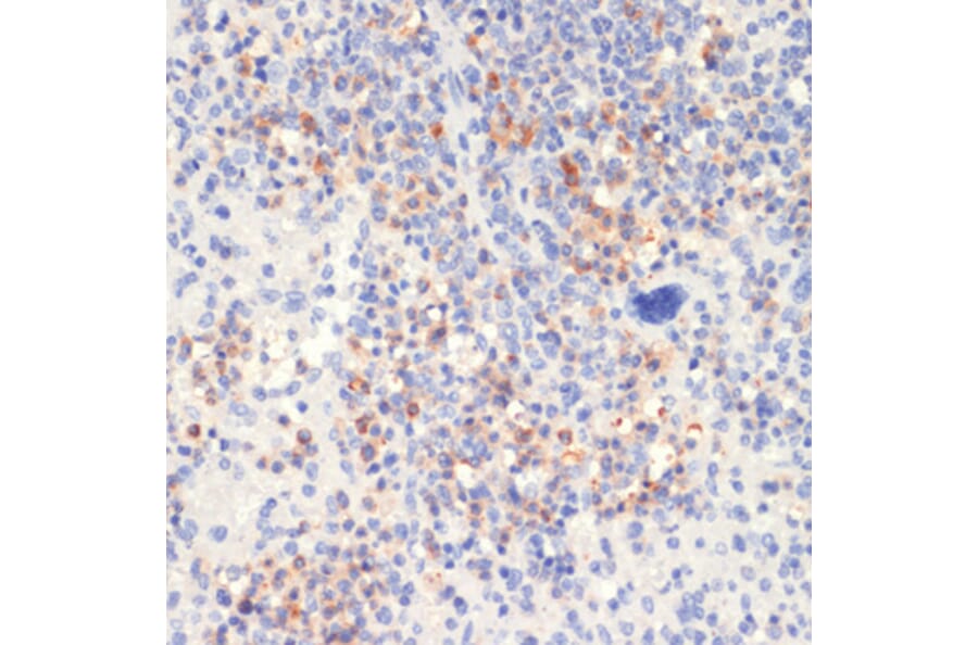 Immunohistochemistry - Anti-PLCG 2 (phospho Tyr1217) Antibody (A88327) - Antibodies.com