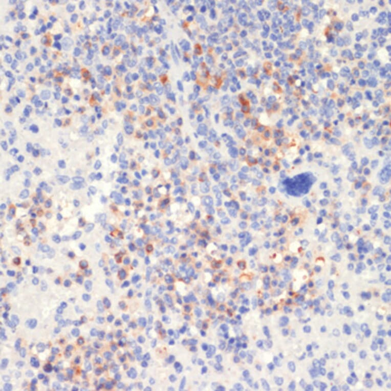 Immunohistochemistry - Anti-PLCG 2 (phospho Tyr1217) Antibody (A88327) - Antibodies.com