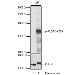 Western Blot - Anti-PLCG 2 (phospho Tyr759) Antibody (A88328) - Antibodies.com