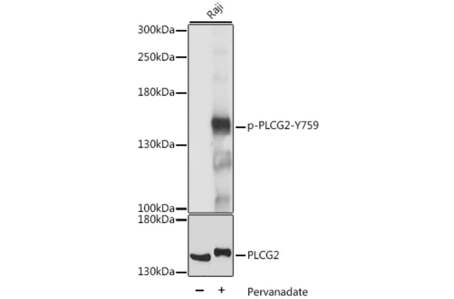 Western Blot - Anti-PLCG 2 (phospho Tyr759) Antibody (A88328) - Antibodies.com