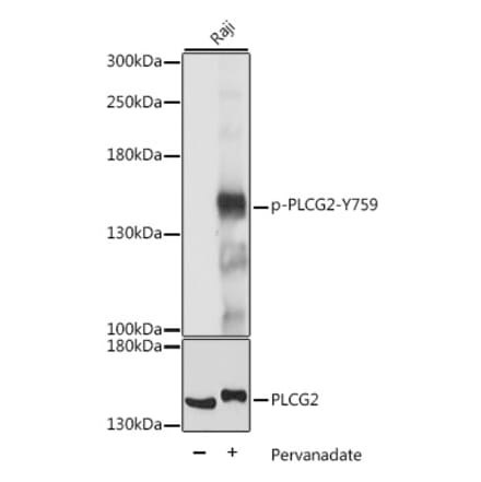 Western Blot - Anti-PLCG 2 (phospho Tyr759) Antibody (A88328) - Antibodies.com