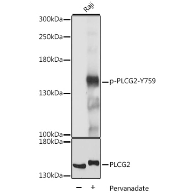 Western Blot - Anti-PLCG 2 (phospho Tyr759) Antibody (A88328) - Antibodies.com