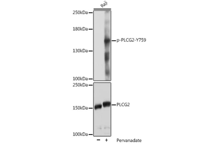Western Blot - Anti-PLCG 2 (phospho Tyr759) Antibody (A88328) - Antibodies.com