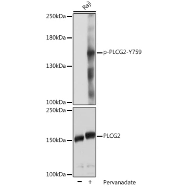 Western Blot - Anti-PLCG 2 (phospho Tyr759) Antibody (A88328) - Antibodies.com