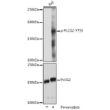 Western Blot - Anti-PLCG 2 (phospho Tyr759) Antibody (A88328) - Antibodies.com