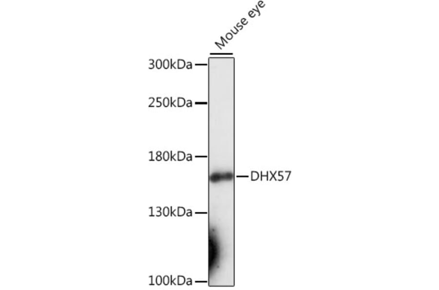 Western Blot - Anti-DHX57 Antibody (A88329) - Antibodies.com