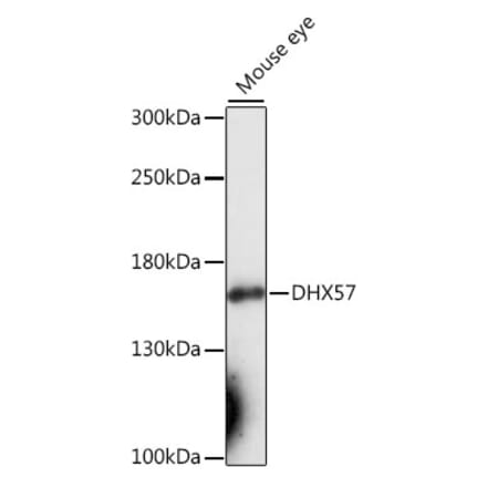 Western Blot - Anti-DHX57 Antibody (A88329) - Antibodies.com