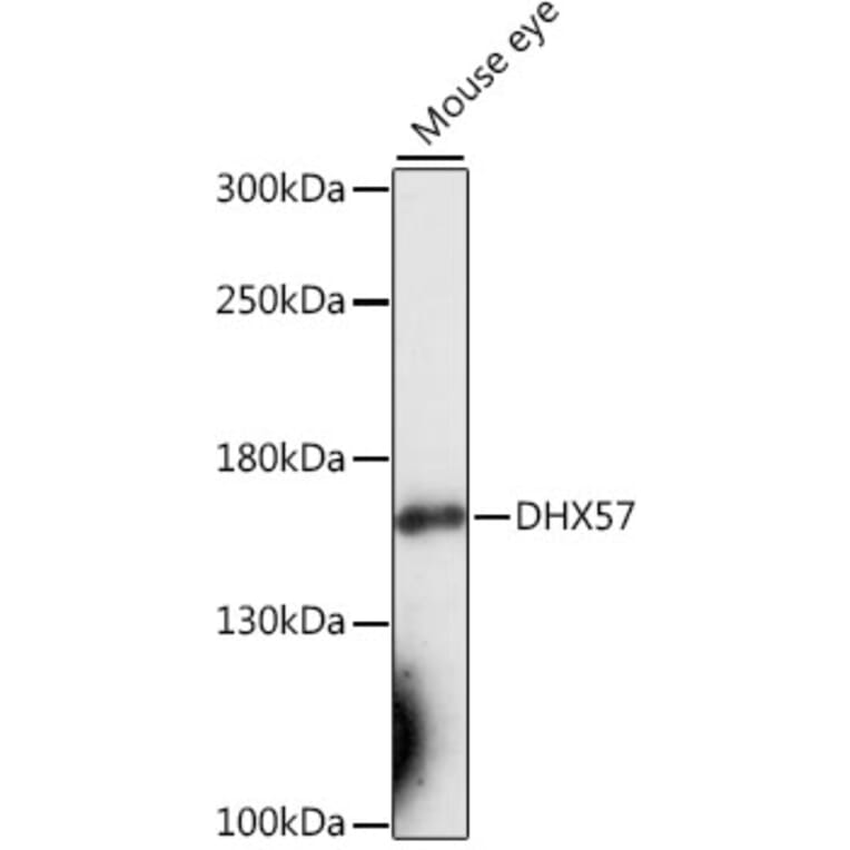 Western Blot - Anti-DHX57 Antibody (A88329) - Antibodies.com