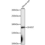 Western Blot - Anti-DHX57 Antibody (A88329) - Antibodies.com