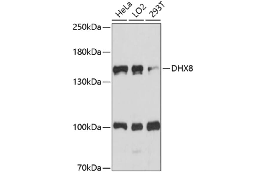 Western Blot - Anti-DHX8/prp22 Antibody (A88330) - Antibodies.com