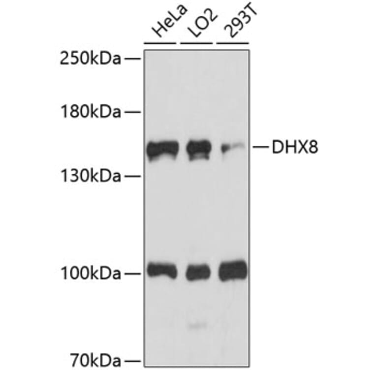Western Blot - Anti-DHX8/prp22 Antibody (A88330) - Antibodies.com