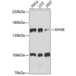 Western Blot - Anti-DHX8/prp22 Antibody (A88330) - Antibodies.com