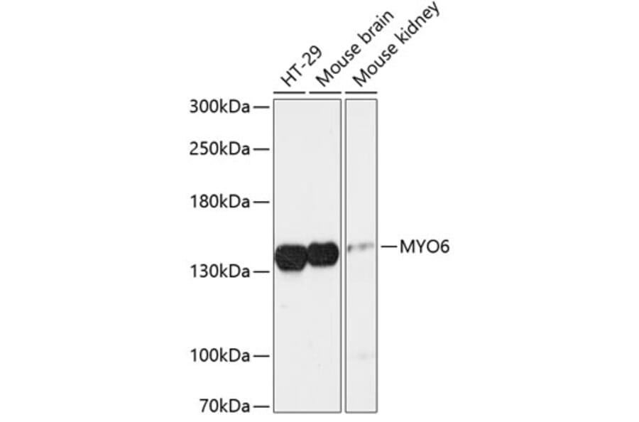 Western Blot - Anti-MYO6 Antibody (A88331) - Antibodies.com