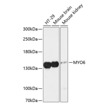 Western Blot - Anti-MYO6 Antibody (A88331) - Antibodies.com