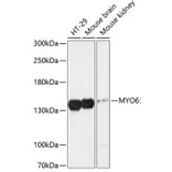 Western Blot - Anti-MYO6 Antibody (A88331) - Antibodies.com