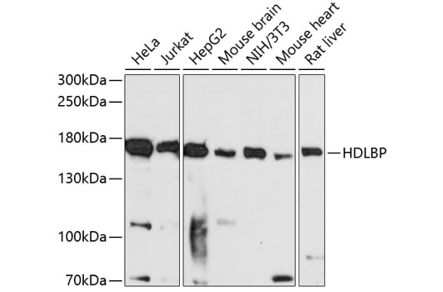 Western Blot - Anti-HDLBP Antibody (A88332) - Antibodies.com
