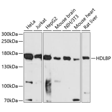 Western Blot - Anti-HDLBP Antibody (A88332) - Antibodies.com