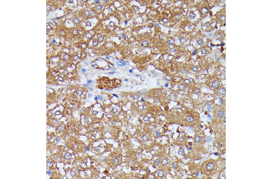 Immunohistochemistry - Anti-HDLBP Antibody (A88332) - Antibodies.com