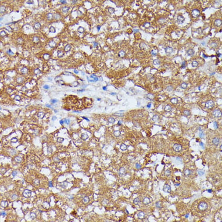 Immunohistochemistry - Anti-HDLBP Antibody (A88332) - Antibodies.com