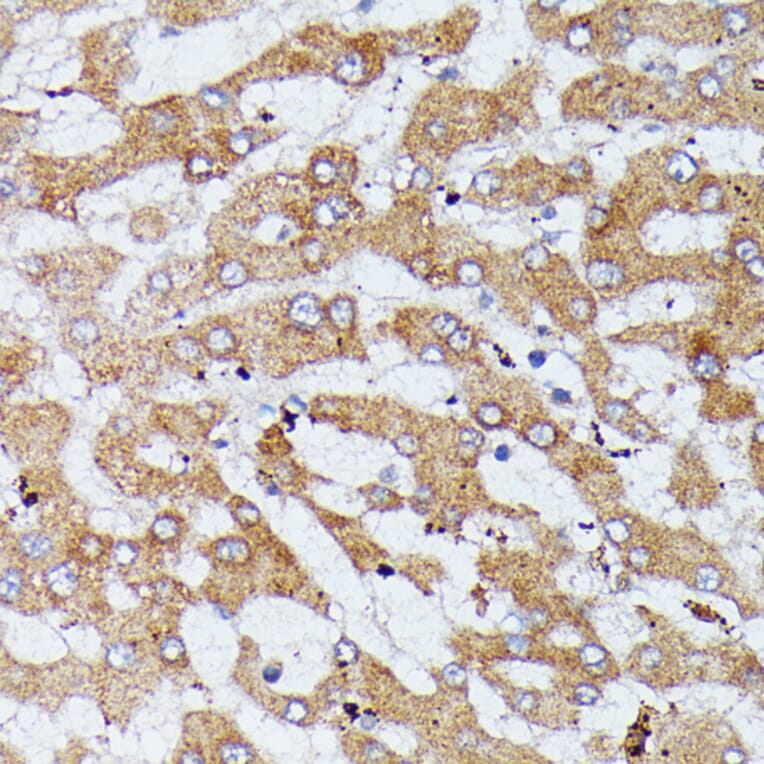 Immunohistochemistry - Anti-HDLBP Antibody (A88332) - Antibodies.com