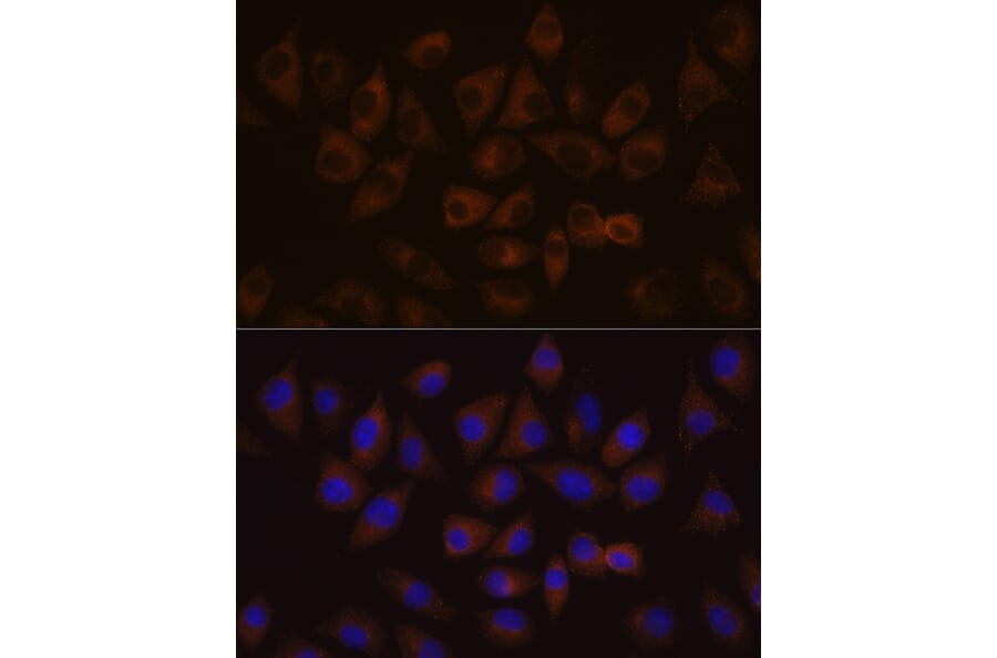 Immunofluorescence - Anti-HDLBP Antibody (A88332) - Antibodies.com