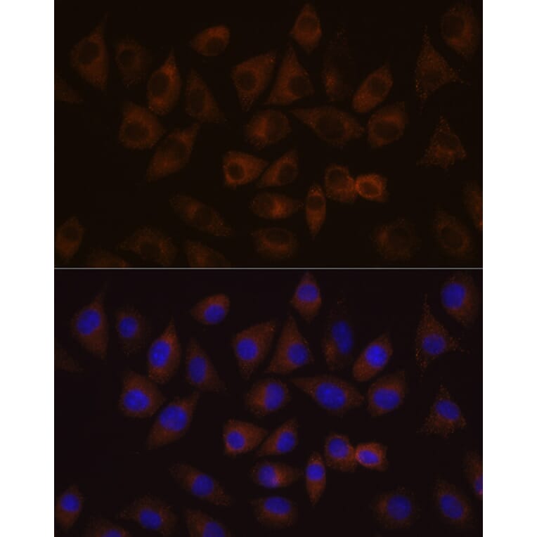 Immunofluorescence - Anti-HDLBP Antibody (A88332) - Antibodies.com