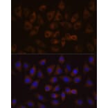 Immunofluorescence - Anti-HDLBP Antibody (A88332) - Antibodies.com