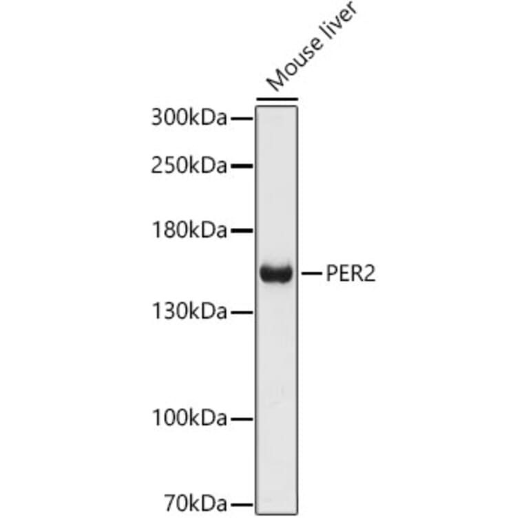 Western Blot - Anti-PER2 Antibody (A88334) - Antibodies.com