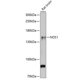Western Blot - Anti-nNOS (neuronal) Antibody (A88335) - Antibodies.com